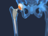 //jlrorwxhpqpqlj5m.ldycdn.com/cloud/prBppKqplnSRqlojorqijm/Medical-Titanium.jpg